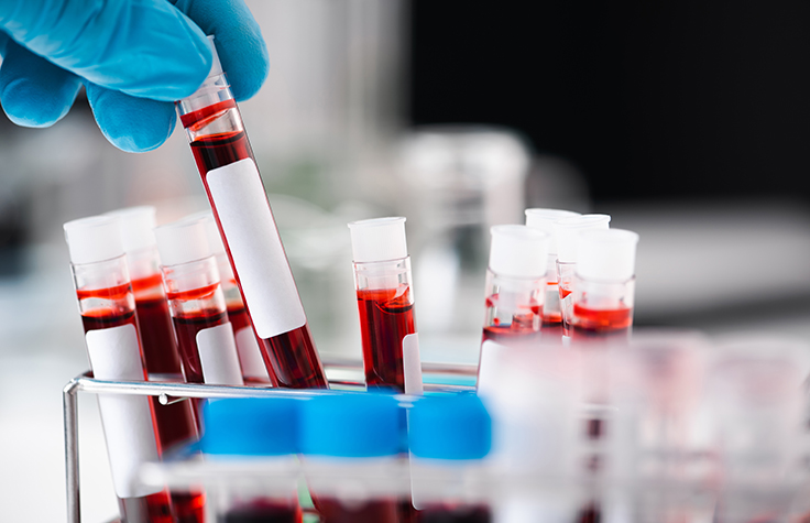 TruSight Oncology 500